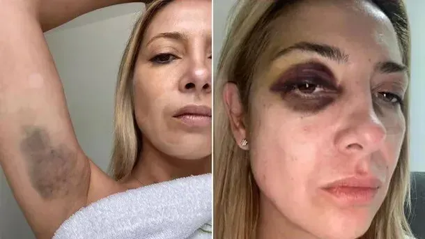 imagen_2024-08-09_101932179